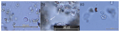 https://soil.copernicus.org/articles/11/583/2025/soil-11-583-2025-f06